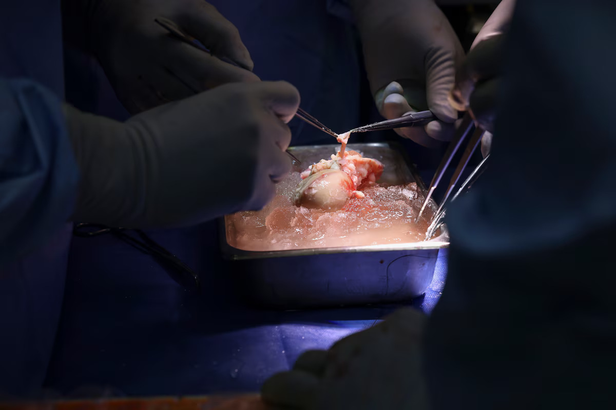The World’s First Genetically-Edited Pig Kidney Transplant into a Living Recipient and the Future of Xenotransplantation